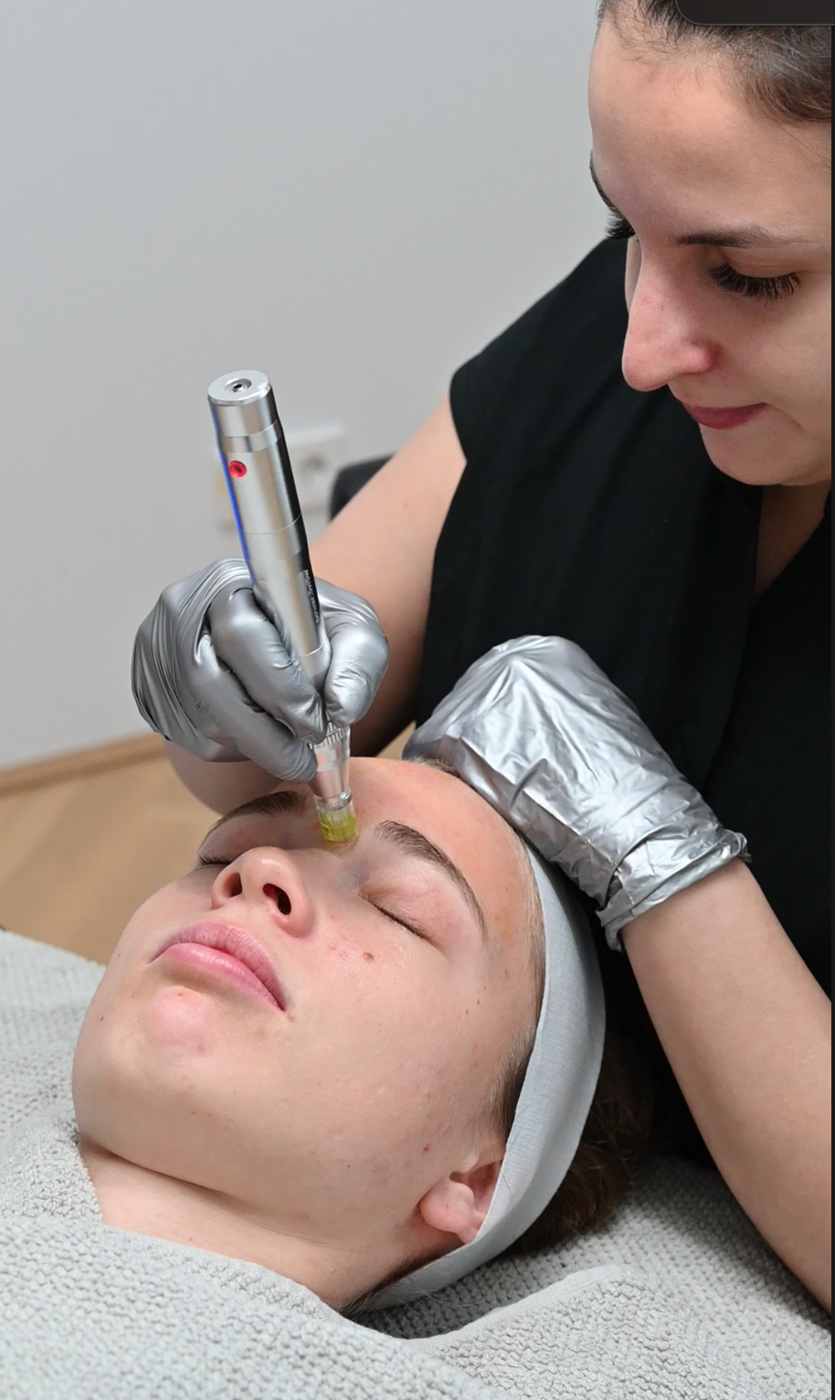 Bild zu Microneedling bei Individual Beauty Wien 